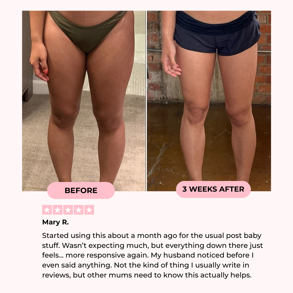 Mireva Fit™ Thigh & Pelvic Trainer